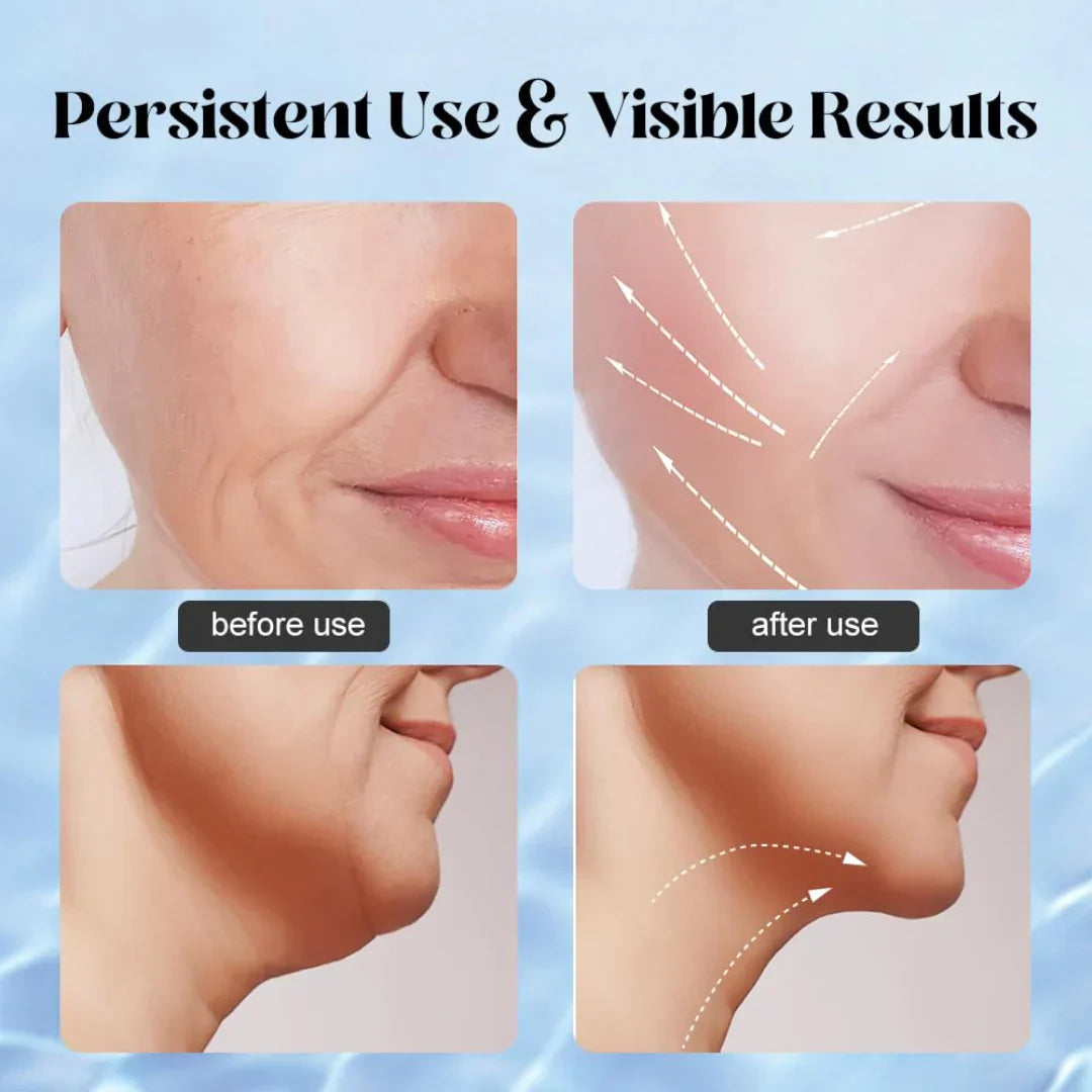 Face Lifting Massager