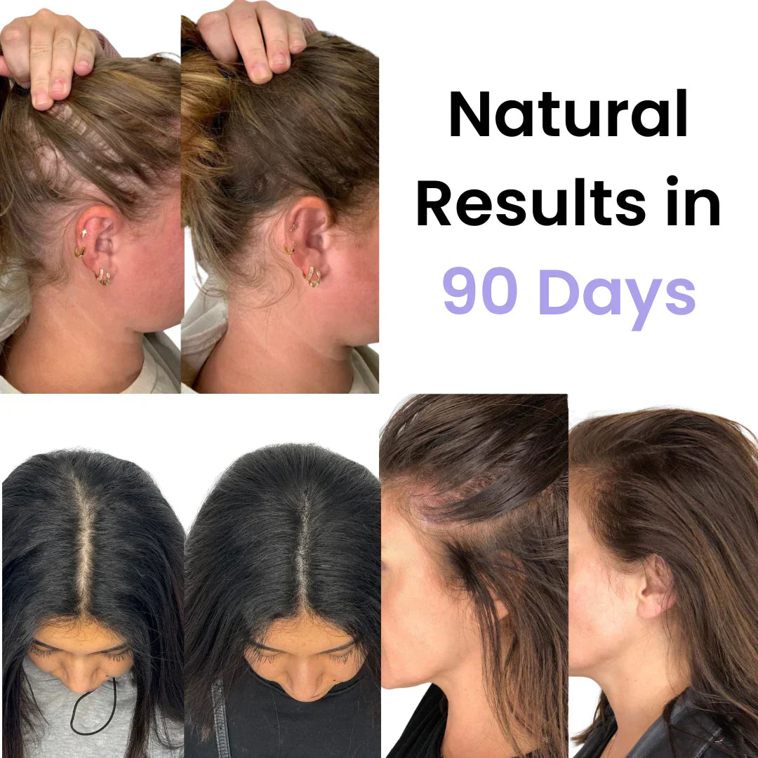 Hair Growth Brush