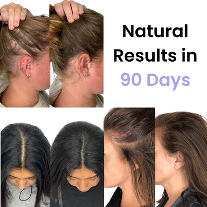 Hair Growth Brush